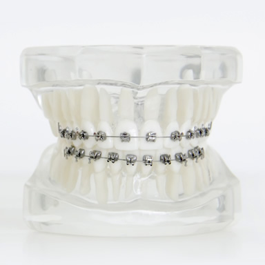 Aparelhos autoligados - Uma nova tecnologia esperando por você!